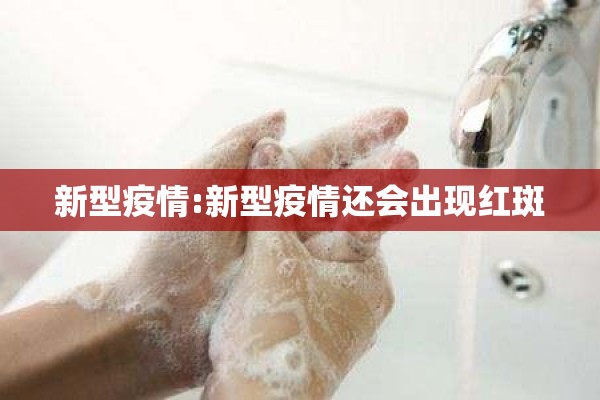 检查疫情防控工作/检查疫情防控工作简报