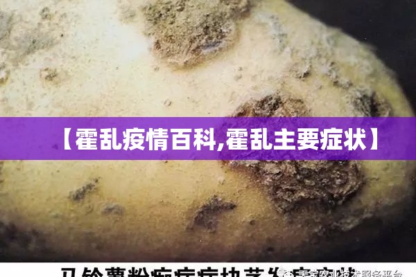 【霍乱疫情百科,霍乱主要症状】