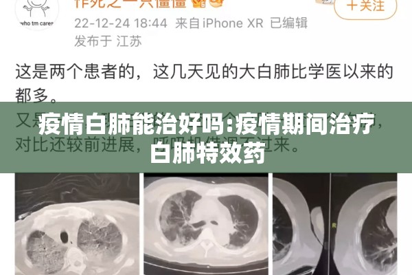 疫情白肺能治好吗:疫情期间治疗白肺特效药 疫情白肺能治好吗:疫情期间治疗白肺特效药
