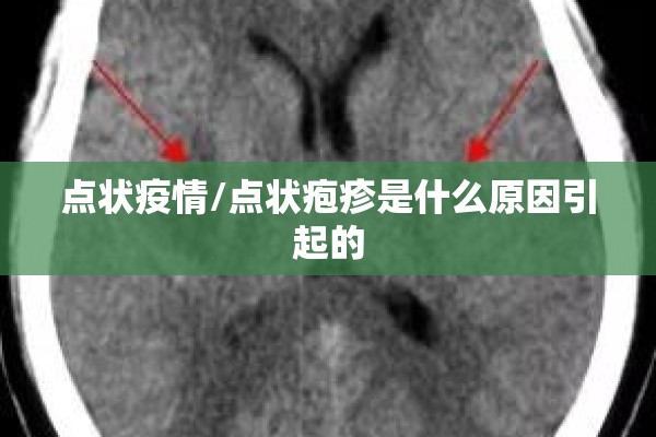 疫情防控工作小组/疫情防控工作总结全文
